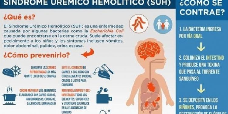 Prevención ante el Síndrome Urémico Hemolítico.