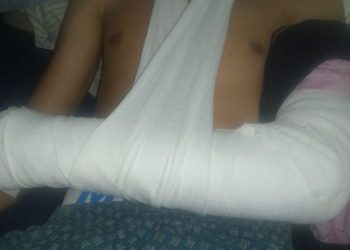 Sierra de la Ventana: denuncia que molieron a golpes a su hijo y la policía «dejó ir» a los agresores