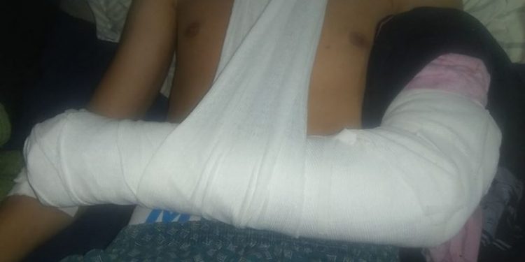 Sierra de la Ventana: denuncia que molieron a golpes a su hijo y la policía «dejó ir» a los agresores