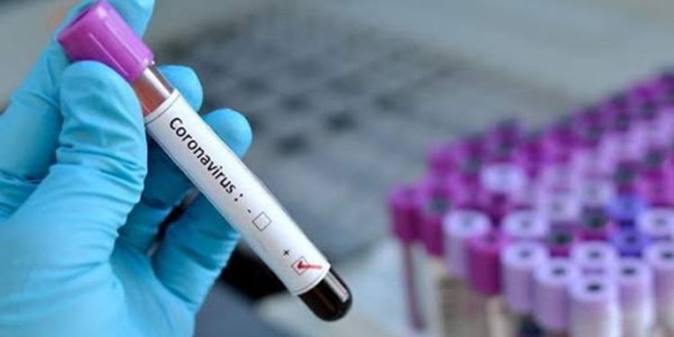Bahía Blanca: Nuevo récord de casos de COVID-19, se registraron 28 infectados.
