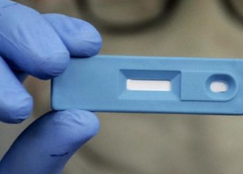 Test detección rapida COVID industria argentina