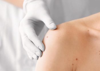 Especialistas recomiendan realziar controles dermatológicos en todas las épocas del año