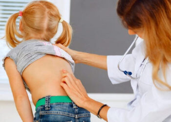 Prevención del a escoliosis