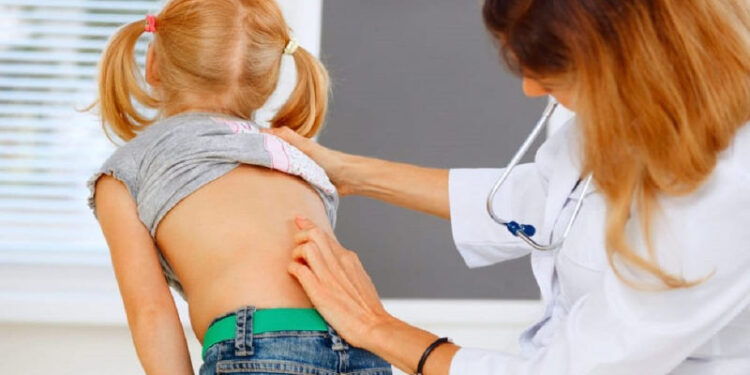 Prevención del a escoliosis