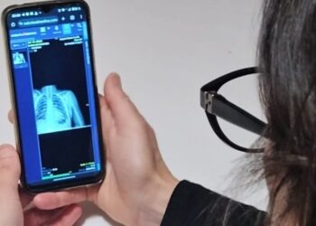 Ya se utiliza la plataforma digital en red que facilita la consulta a distancia de estudios y diagnósticos